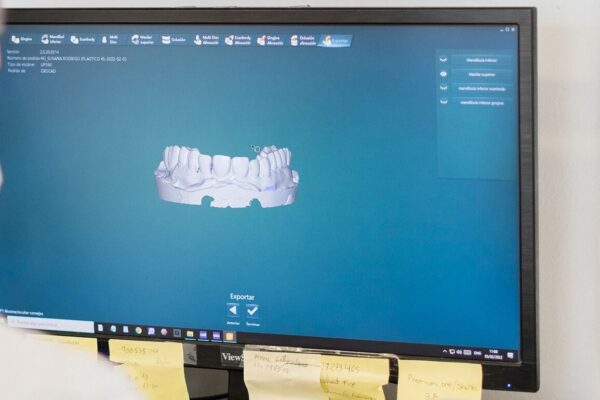 CAD/CAM